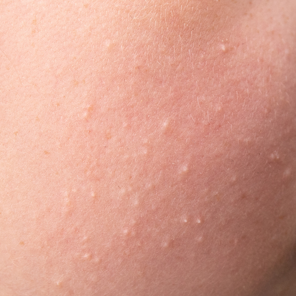 gerstekorrels behandelen