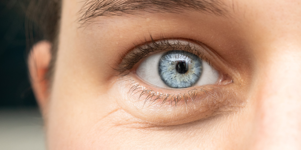 wallen donkere kringen